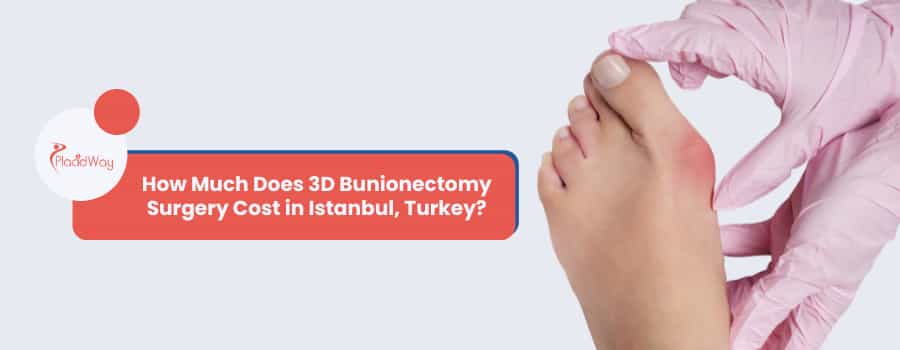 How Much Does 3D Bunionectomy Surgery Cost in Istanbul, Turkey?