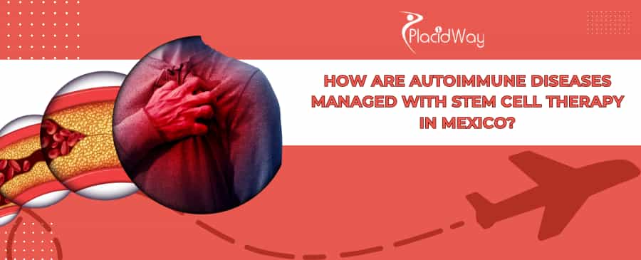 Autoimmune Stem Cell Therapy in Mexico