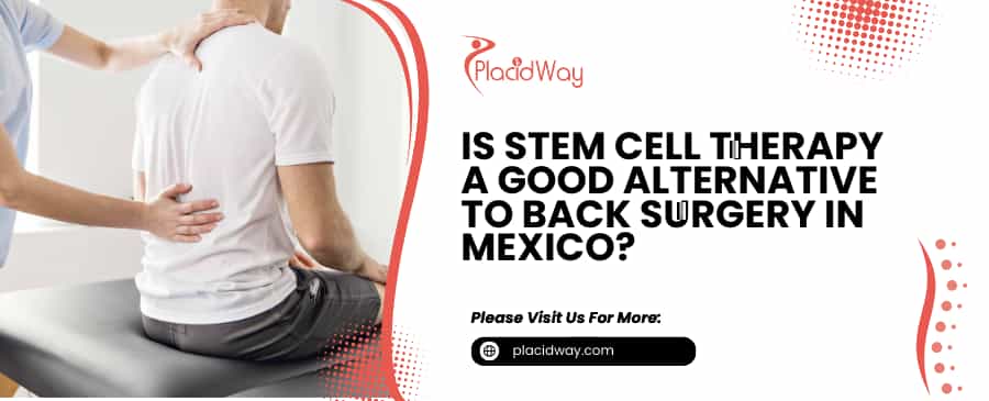 Stem Cell Therapy a Back Surgery in Mexico