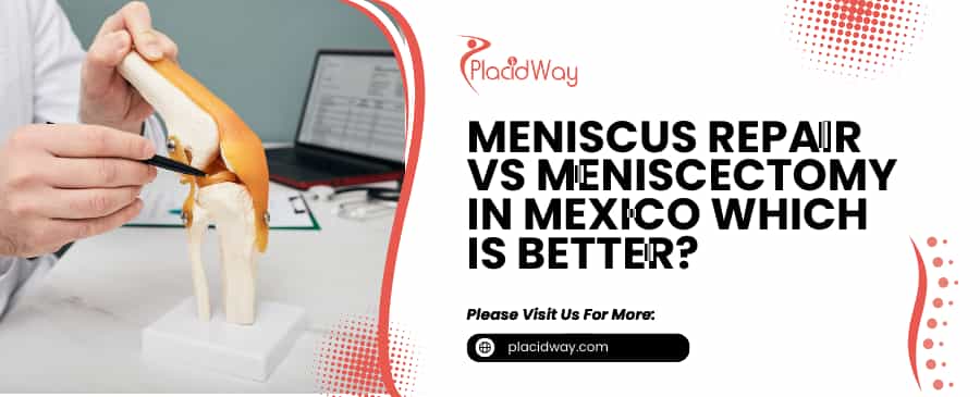 Meniscus Repair vs Meniscectomy in Mexico Which is Better?