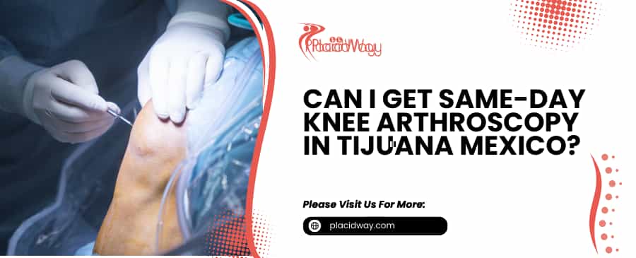 Can I Get Same-Day Knee Arthroscopy in Tijuana Mexico?