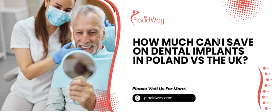Dental Implants in Poland vs the UK