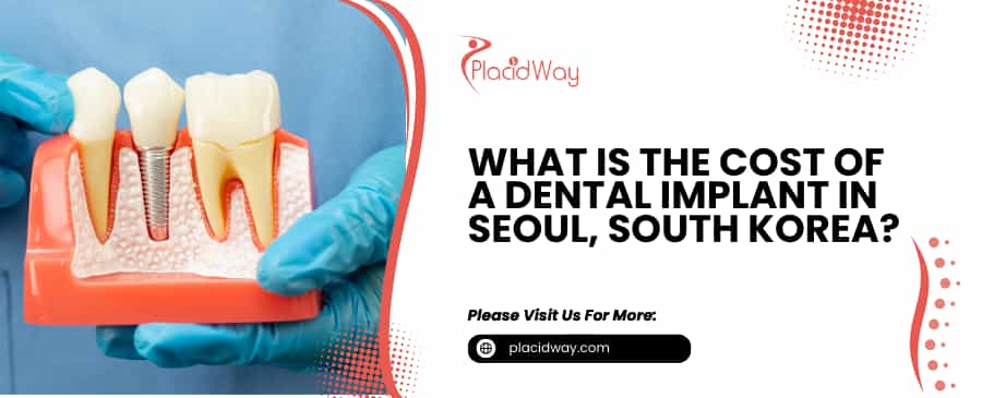Cost of a Dental Implant in Seoul, South Korea