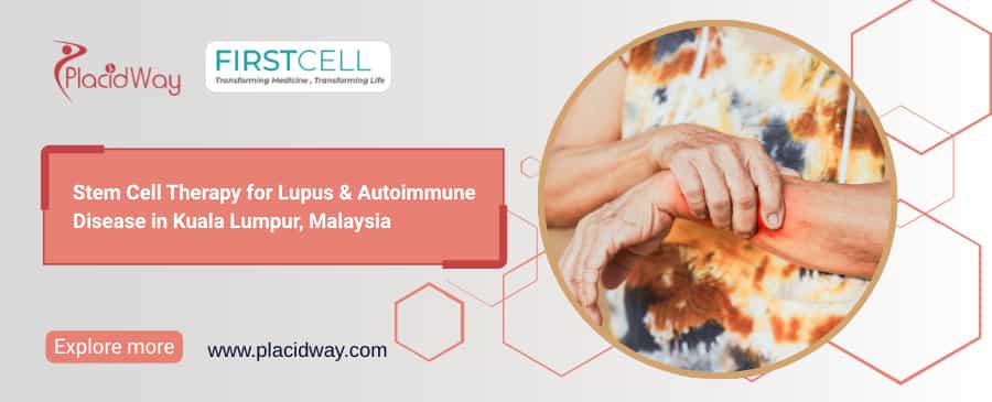 Stem Cell Therapy for Lupus and Autoimmune Disease in Malaysia