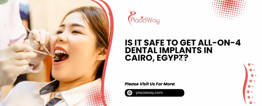 All-on-4 Dental Implants in Cairo, Egypt
