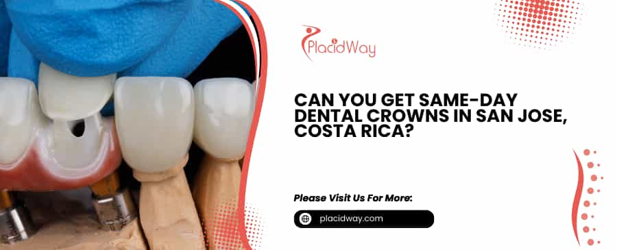 Dental Crowns in San Jose, Costa Rica