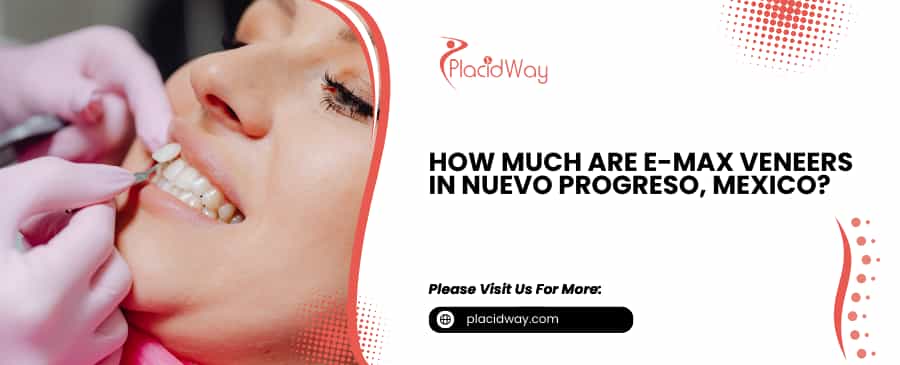 E-max Veneers in Nuevo Progreso, Mexico