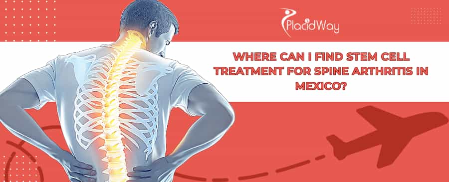 Stem Cell Therapy for Spine Arthritis in Mexico