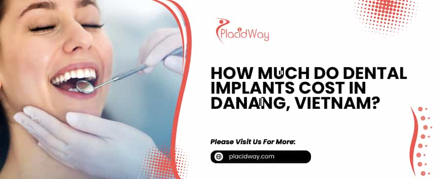 Dental Implants Cost in DaNang, Vietnam