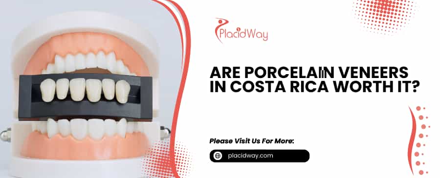 Porcelain Veneers in Costa Rica