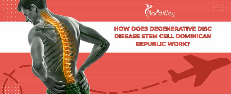 Degenerative Disc Disease Stem Cells DR