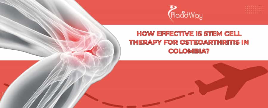 Stem Cell Therapy for Osteoarthritis in Colombia