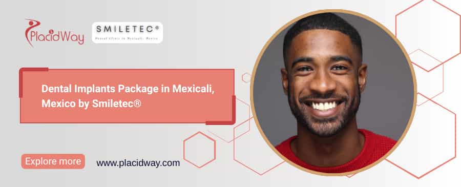 Dental Implants Package in Mexicali: Affordable Tooth Replacement