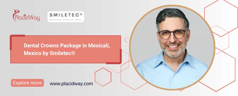 Dental Crowns in Mexicali Mexico: Smiletec Dental Clinic