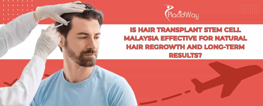 Stem Cell Hair Transplant in Malaysia
