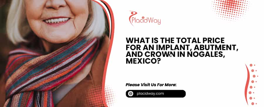 Price for an Implant, Abutment, and Crown in Nogales, Mexico