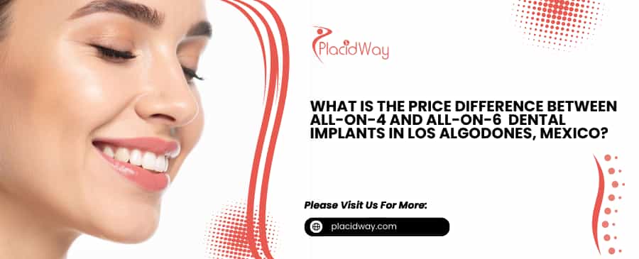 Dental Implants in Los Algodones, Mexico