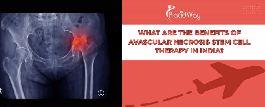 Avascular Necrosis Stem Cell Therapy in India