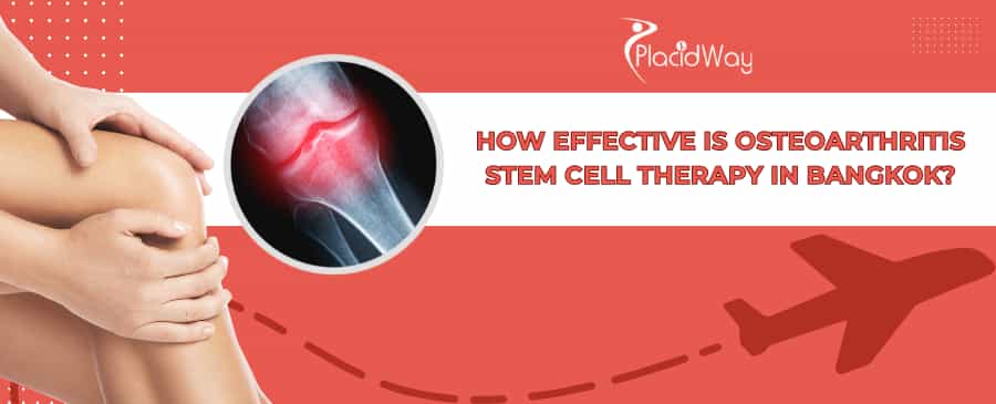 Osteoarthritis Stem Cell Therapy in Bangkok