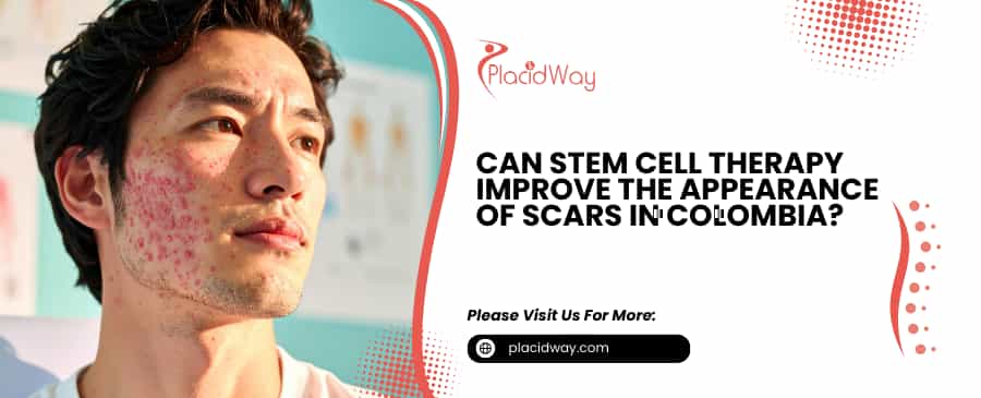Stem Cell Therapy for Scars in Colombia