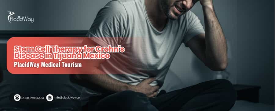 Stem Cell Therapy for Crohn's Disease in Tijuana Mexico