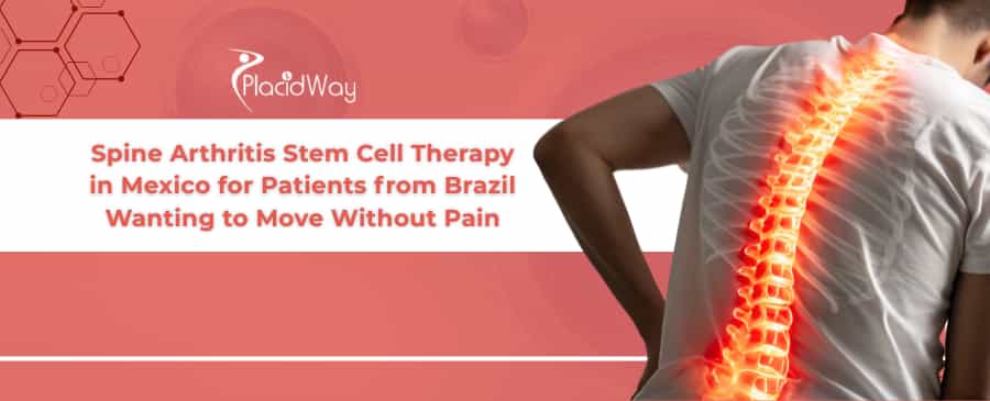 Spine Arthritis Stem Cell Therapy in Mexico
