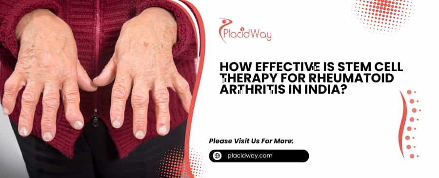 Stem Cell Therapy for Rheumatoid Arthritis in India?