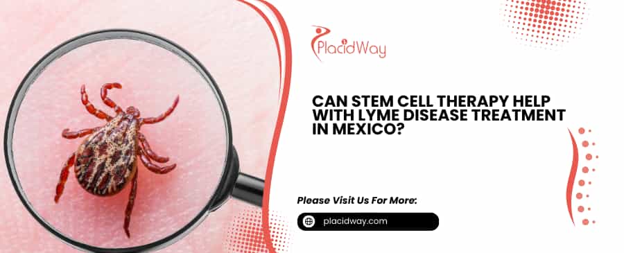 Lyme disease Treatment in Mexico