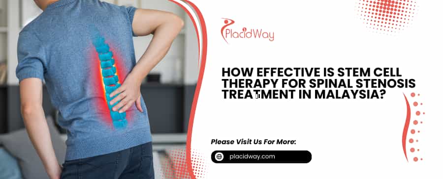 Stem Cell Therapy for Spinal Stenosis Treatment in Malaysia