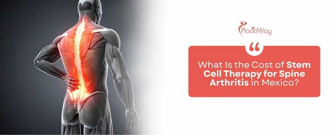 New Hope With Hip Replacement Journey In Mexico With Placidway  A Story Of Adrian From Canada