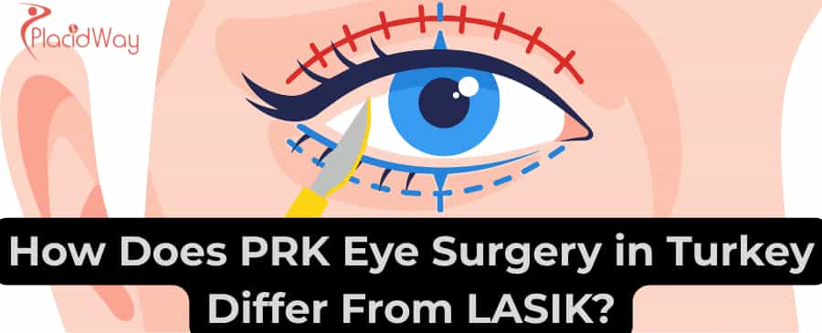 PRK eye surgery in Turkey