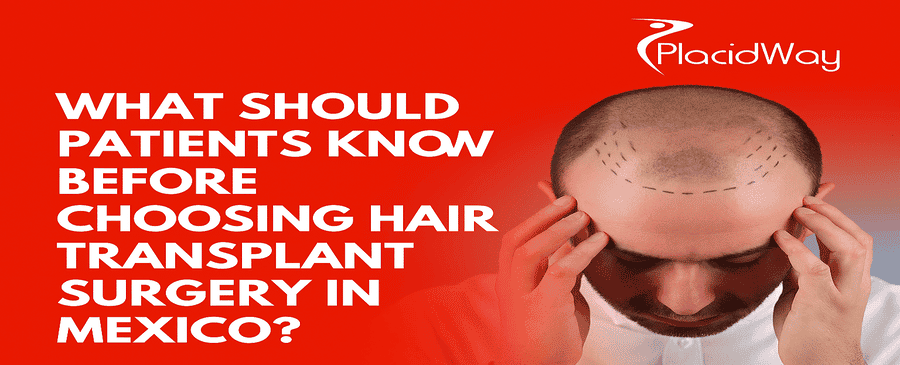 Choosing Hair Transplant Surgery in Mexico