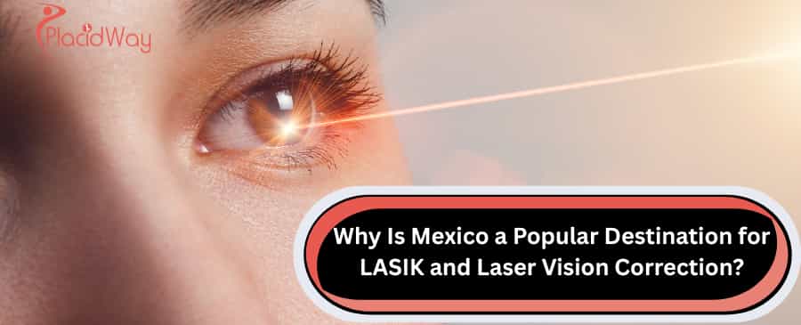 LASIK vision correction in Mexico