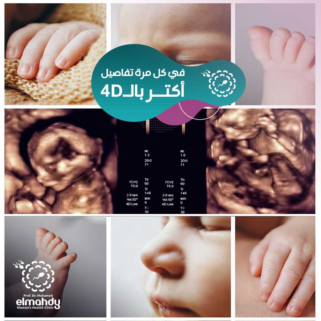 IVF in Egypt - Dr. Mohamed El Mahdy