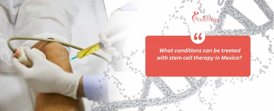 stem cell therapy in Mexico