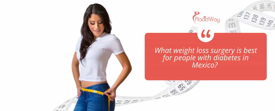 weight loss surgery in Mexico