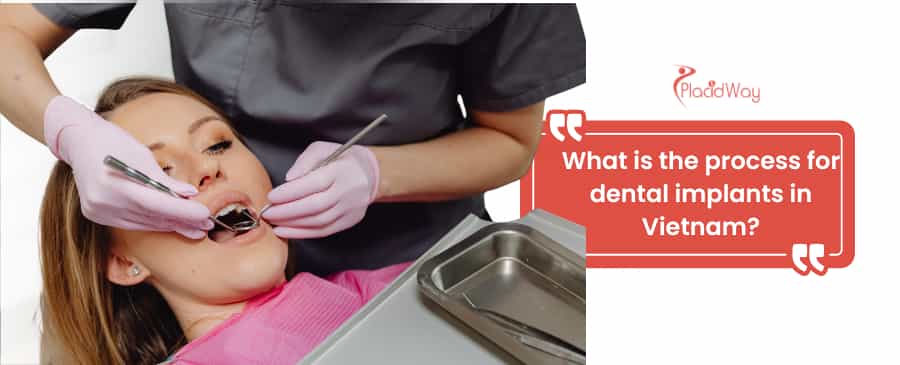 dental implants in Vietnam