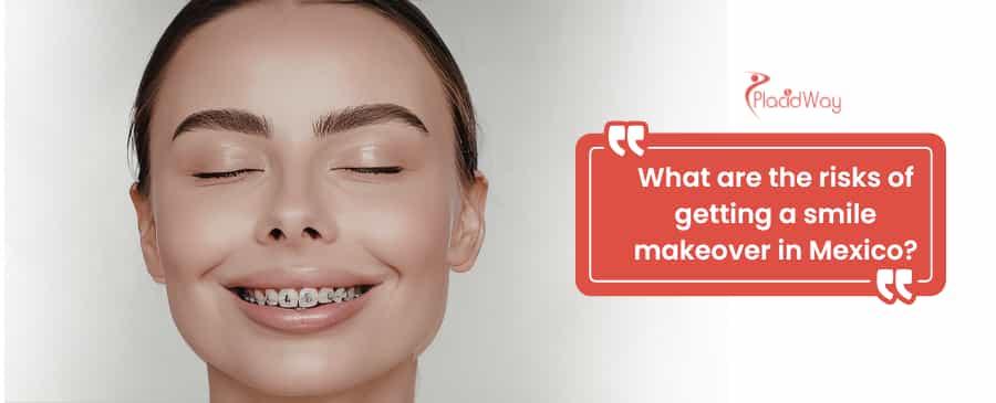 Smile makeover in Mexico