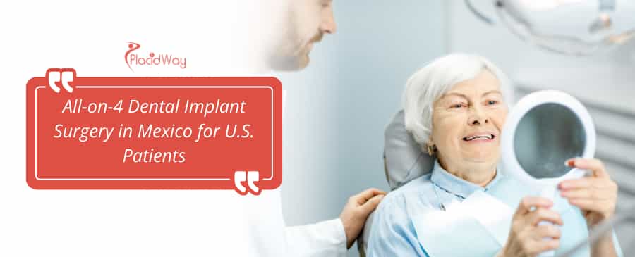 all on 4 dental implants in Mexico