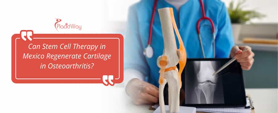 stem cell therapy in Mexico