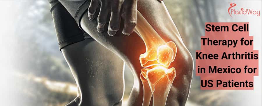stem cell therapy for knee arthritis in Mexico