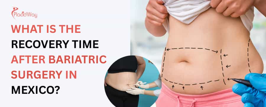What is the recovery time after bariatric surgery in Mexico?