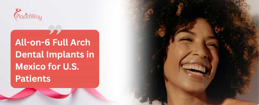 All-on-6 Full Arch Dental Implants in Mexico for U.S. Patients