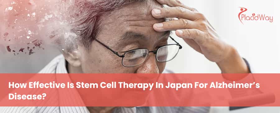 How effective is stem cell therapy in Japan for Alzheimer’s disease?