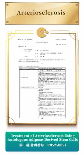 Japan Stem Cell Therapy for Stroke | Osaka Clinic