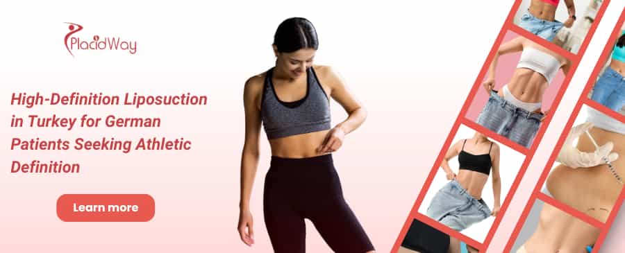 Liposuction in Turkey for German Patients