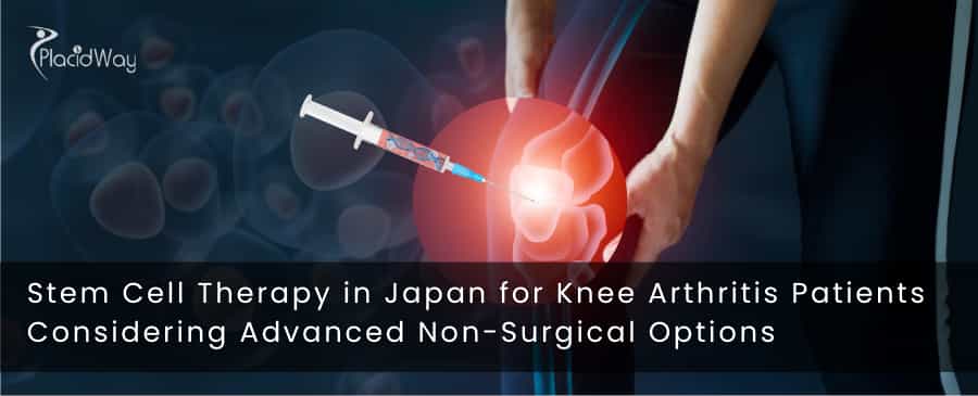 Stem Cell Therapy in Japan for Knee Arthritis Patients Considering Advanced Non-Surgical Options