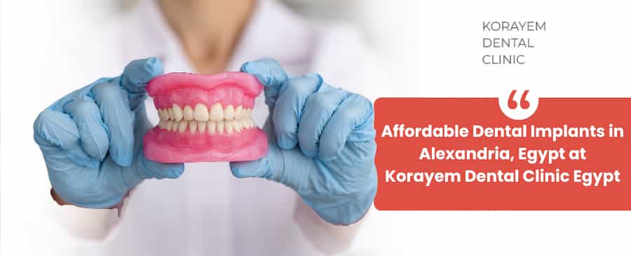 dental implants in Egypt