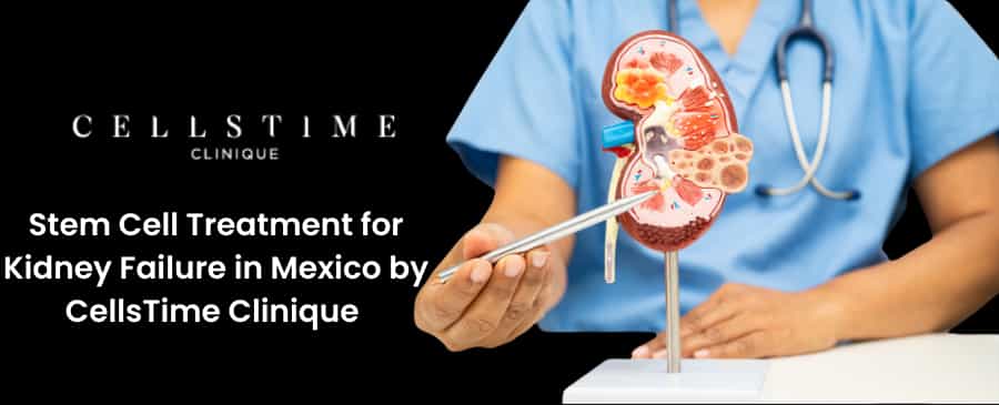 Stem Cell Treatment for Kidney Failure in Mexico by CellsTime Clinique 