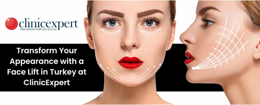 facelift in Turkey